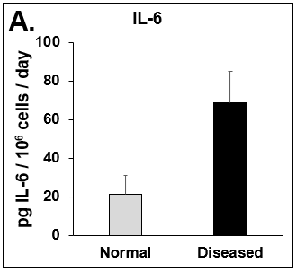 Expression of pro-inflammatory cytokines and fibrotic markers. Levels of (A) IL-6, a pro-inflammatory cytokine, and (B) MCP-1, a pro-inflammatory chemokine, in Normal (grey bar) and Diseased (black bar) PHHs in the hTCS on day 14. The fibrotic markers of (C) CK-18 and (D) TGF-β were measured in Normal (grey bar) and Diseased (black bar) PHHs on day 14. Error bars represent standard deviation (n ≥ 3 wells).
