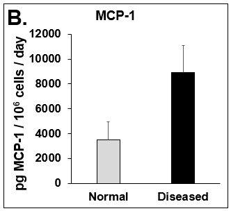 Expression of pro-inflammatory cytokines and fibrotic markers. Levels of (A) IL-6, a pro-inflammatory cytokine, and (B) MCP-1, a pro-inflammatory chemokine, in Normal (grey bar) and Diseased (black bar) PHHs in the hTCS on day 14. The fibrotic markers of (C) CK-18 and (D) TGF-β were measured in Normal (grey bar) and Diseased (black bar) PHHs on day 14. Error bars represent standard deviation (n ≥ 3 wells).