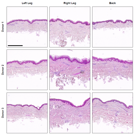 Figure 3. Histological Assessment of Dermatomed Excised Human Skin.