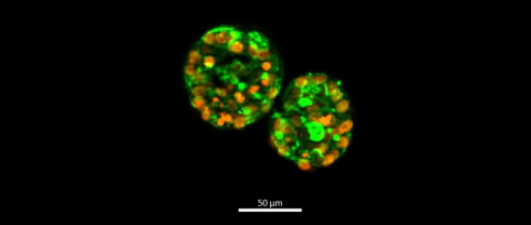 Figure 1. Human Thyroid Microtissues Cultured in Matrigel Coated 96-well Plates