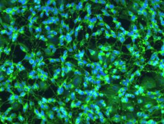 /extracellular-matrices