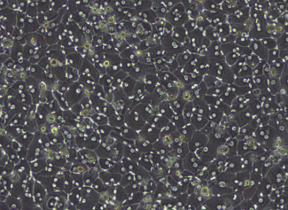 Protocol - Primary Human Hepatocytes