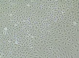 Protocol - Primary Human Liver-derived Endothelial Cells